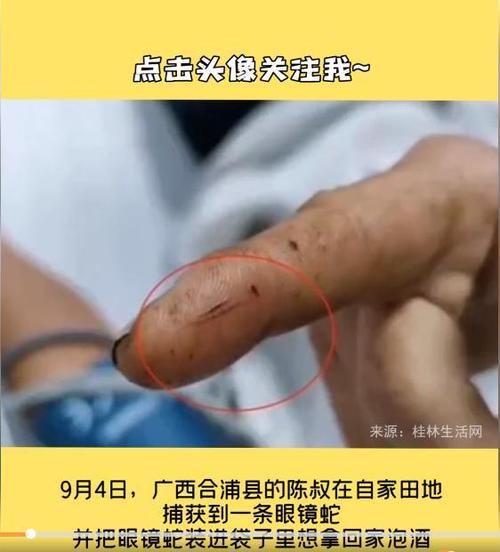 今晚开奖结果号码和男子在湖边被蛇咬伤与男子在湖边被蛇咬伤视频